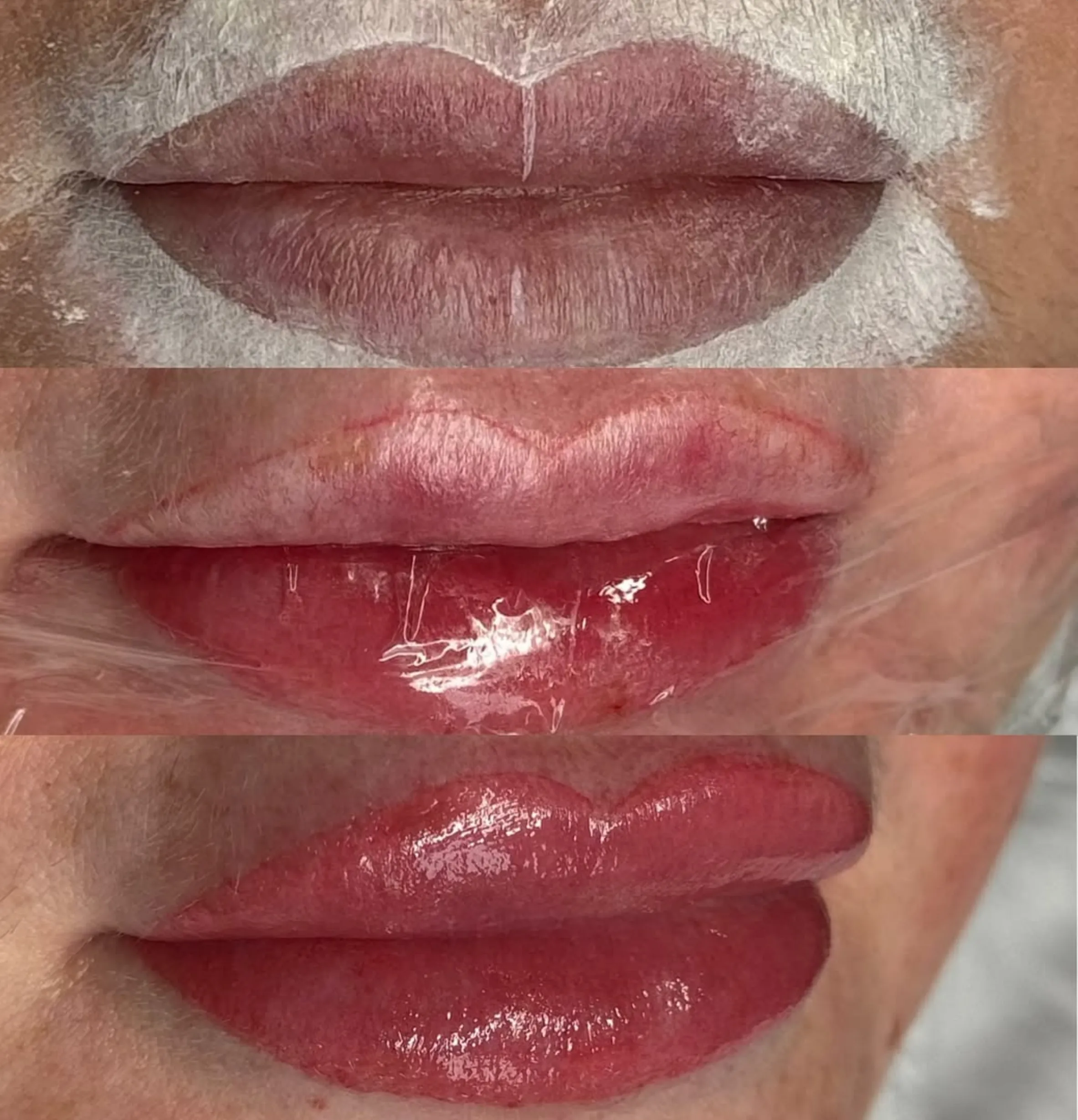 lip tattoo skin prep