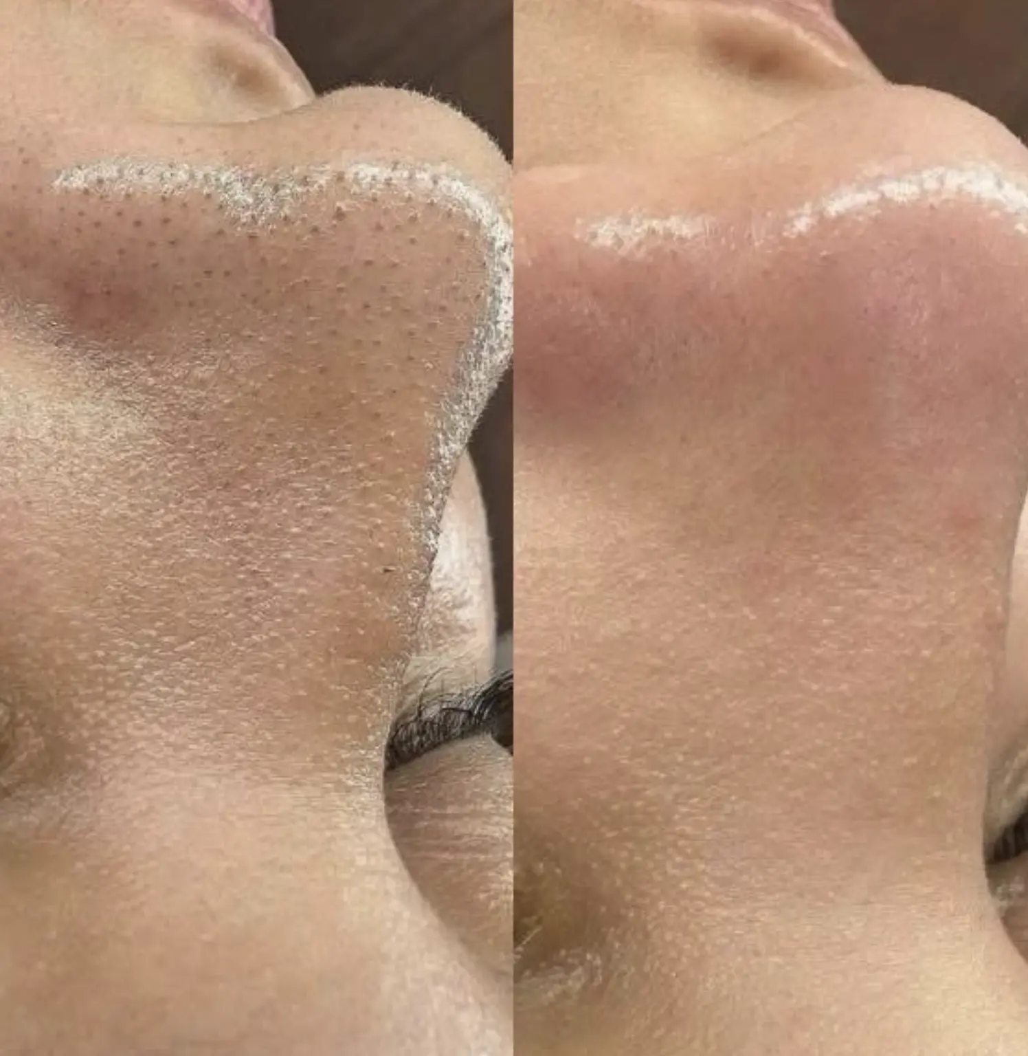 best facial in brisbane